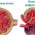 Nesklerosis v kota